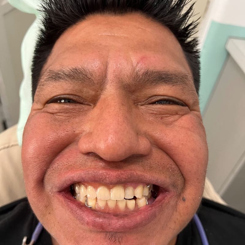 National Smiles Month